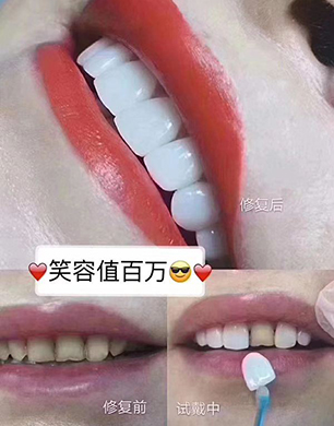 �S��������Ӗ