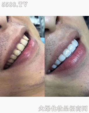 ��������Ӗ����