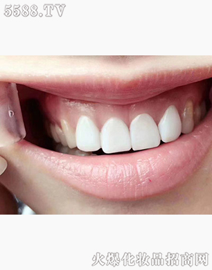 ���������Ӗ����