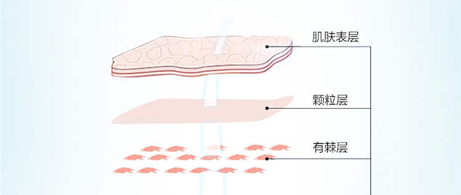 �f�͸߿ƽ�ĸֲ�;��A¶