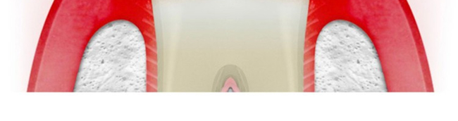 �������������ࣨ��ˬ���m��