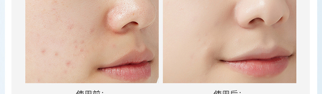 ��������o���A���