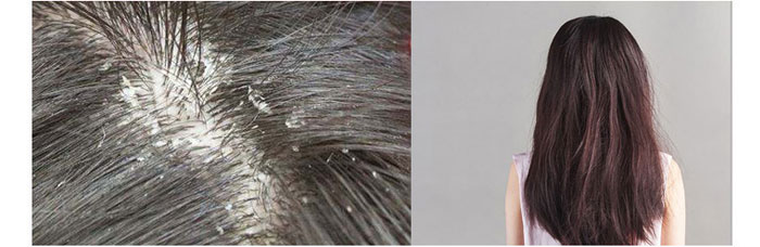 ���ϼ���-�Ř�ɽ����ϴ�l��