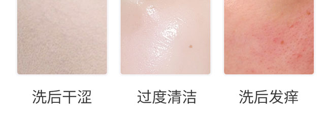 伊美拉氨基酸洗面奶 伊美拉氨基酸洗面奶