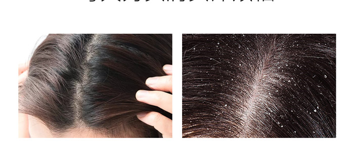 ����ֲ��ȥм����ϴ�l��