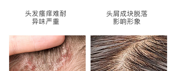 ����ֲ��ȥм����ϴ�l��