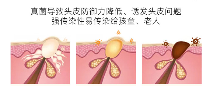 ����ֲ��ȥм����ϴ�l��