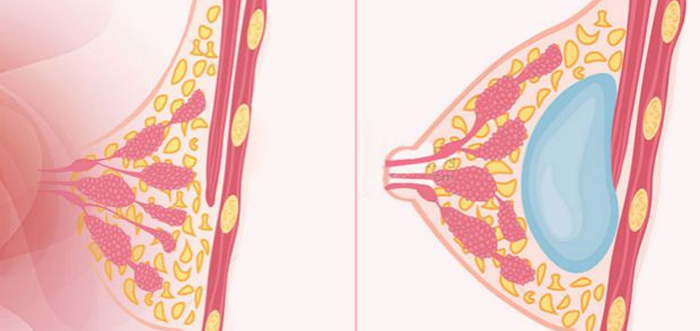 ���۷����ز�Ƥ��