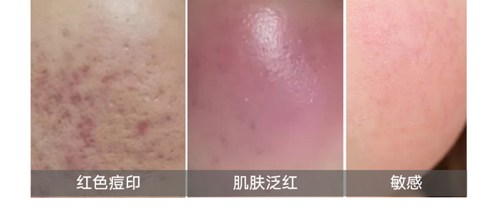 �tʩ�����������oҺ