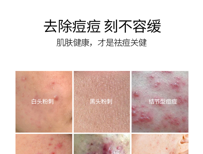 詳情-植萃平衡水 詳情-植萃平衡水