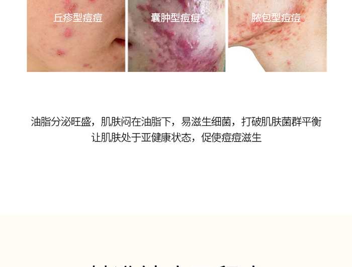 詳情-植萃平衡水 詳情-植萃平衡水