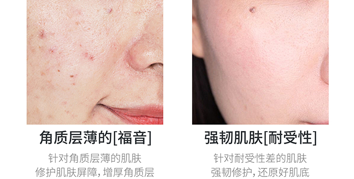 �ߵر������o˪